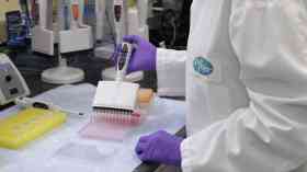 UK signs new deal for 35 million vaccines