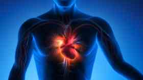 Rise in excess heart deaths in under 65s