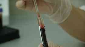 HIV testing in King’s A&E diagnoses 32 new cases