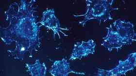 NHS spends big on cancer drugs developed with public funds