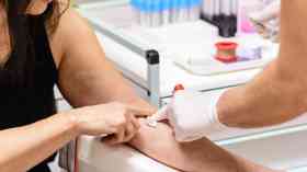 21 weeks for routine NHS blood tests in London