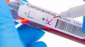 £4m data project to accelerate coronavirus research