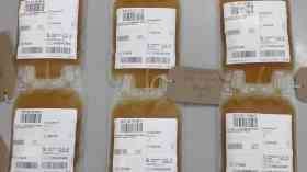First patients receiving convalescent plasma transfusions