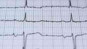 Poor follow up care failing heart failure patients