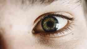 Revolutionary treatment for blindness in children on NHS