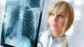 One stop cancer facility to be trialled in South Wales 