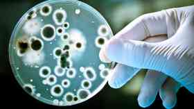 NHS sinks contain multi-drug resistant bacteria