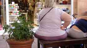 CCGs must stop restricting weight loss surgery, BOMSS and RCS says
