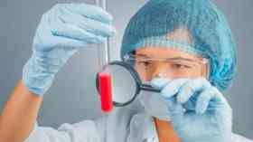 Platelet test found to predict cancer risk , research finds 
