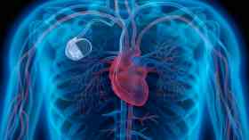 UK’s first artificial heart pump due to trial in 2018