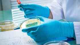 Scots NHS introduce HPV test for cervical cancer