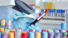 NHS to pilot potentially revolutionary blood test