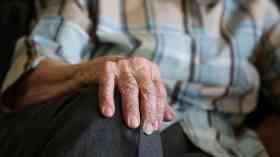 Discussions with dementia patients improves quality of life
