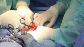 BAME organ donations are at a record high