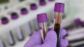 NHS blood tests hit by tube supply chain disruption
