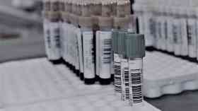 Large scale study of coronavirus immunity begins