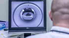 Imaging equipment ‘woefully underfunded’ say UK radiologists