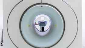 Hospitals in urgent need of more scanners and staff