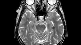 Brain cancer treatment aid now available