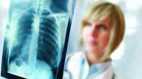 New x-ray machine for breast cancer patients