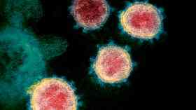 Coronavirus antibodies tests putting ‘public at risk'