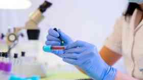 New testing centre to fast-track variant vaccines