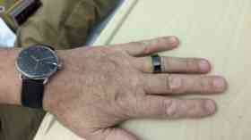 Wearable tech trial for cancer patients in Manchester