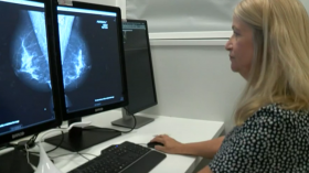 AI software trialled to support breast cancer screening