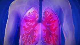 Lung disease procedure to be routinely available