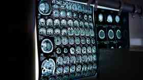 NHS lacks 6,000 staff needed to run testing centres