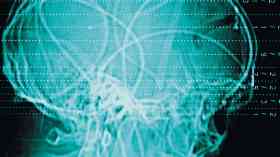 NHS England approves stroke treatment 