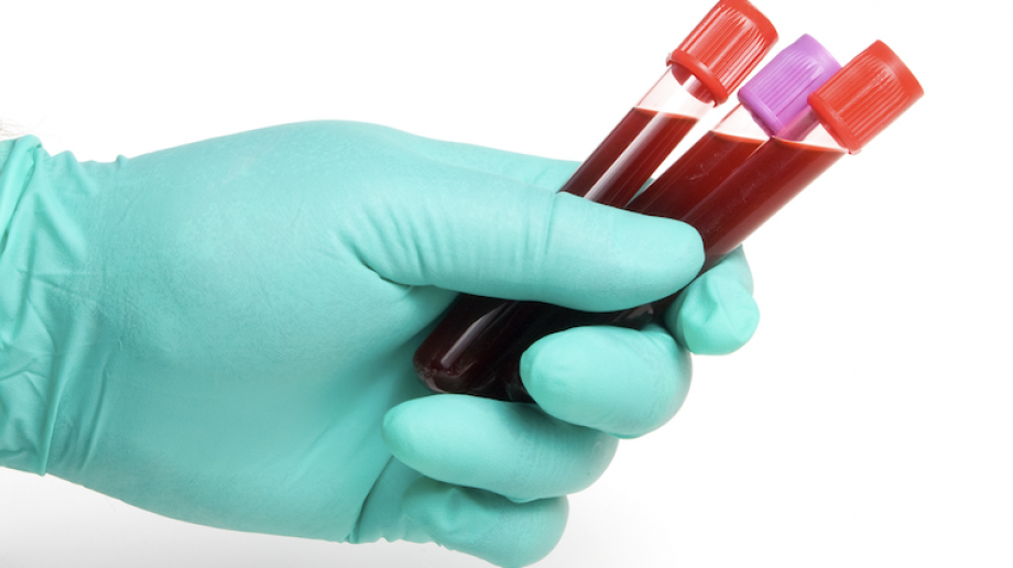 NHS Blood and Transplant to send out home testing kits in quest for O negative donors