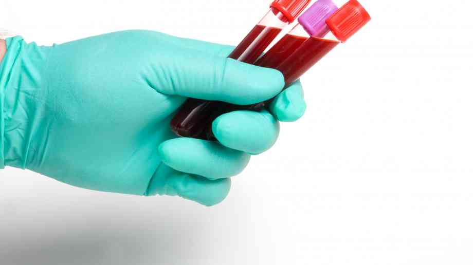 omodo blood poses new treatment for antibiotic resistant bacteria