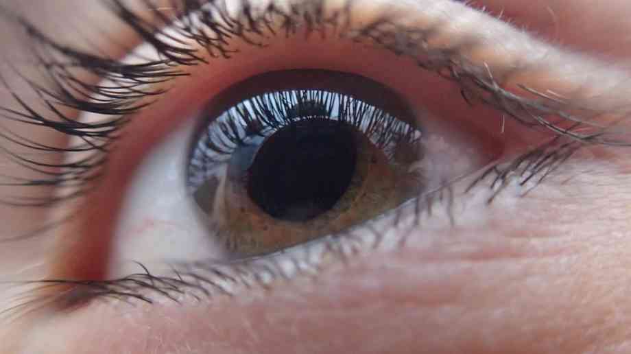 People at low risk of glaucoma can avoid unnecessary referral