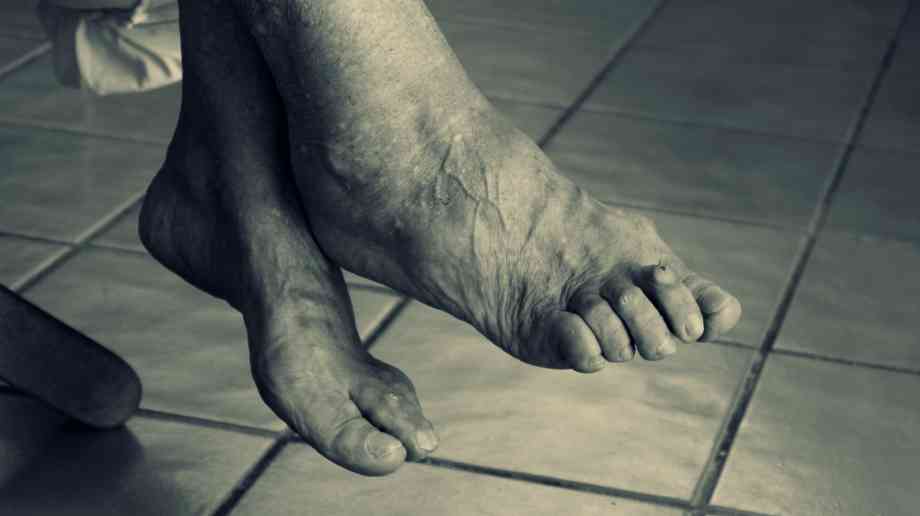 Arthritis drug could reduce dementia risk