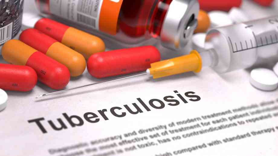 Tuberculosis at lowest levels since 1960, reports PHE