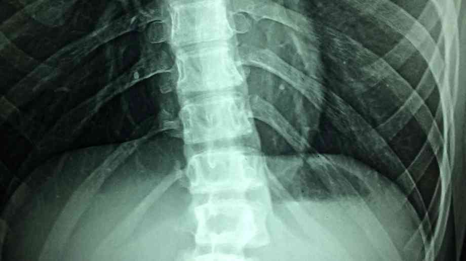 Portsmouth Hospitals NHS Trust ‘must review’ backlog of x-rays